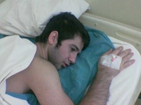 Açık Kıl Dömesi Ameliyatı Riskleri ve Sonrası