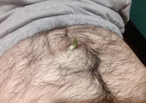 Göbek Kılı Nasıl Alınmalı?